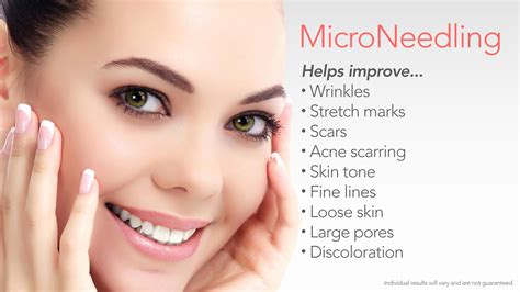 benefits of microneedling with prp