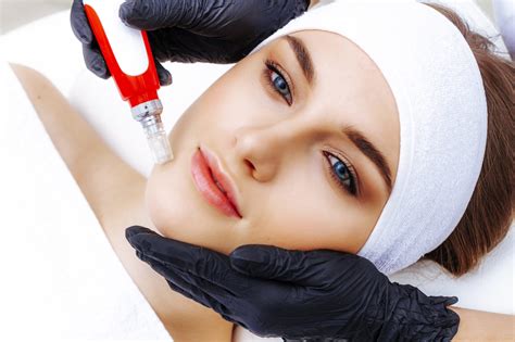 best microneedling near me