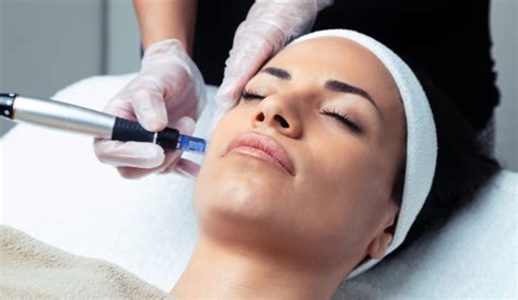 boca raton microneedling