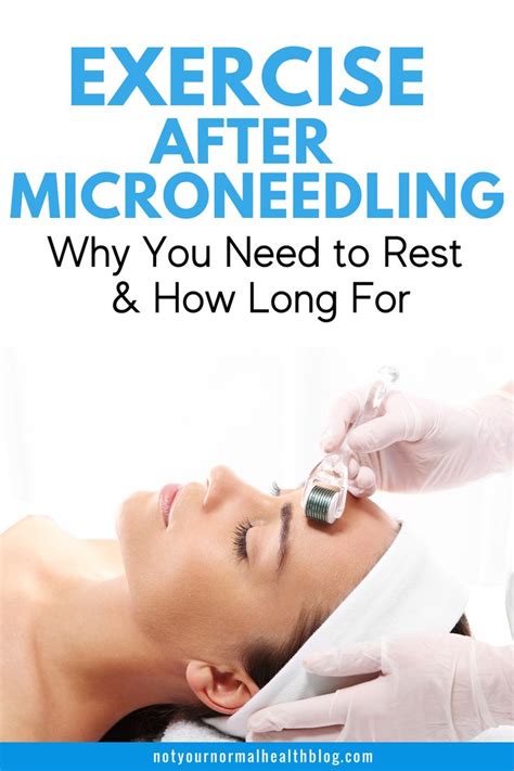 can you workout after microneedling