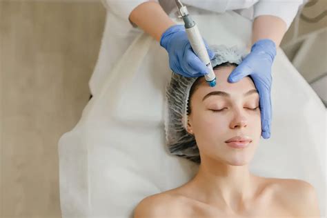 chicago microneedling