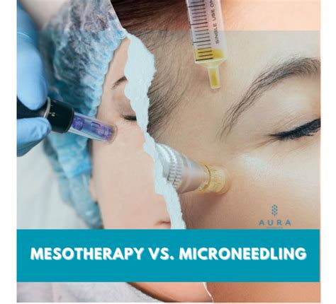 dermaheal skin booster with mesotherapy vs. microneedling