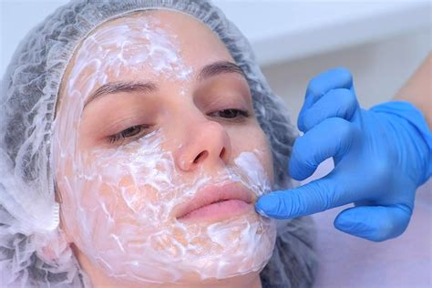 face numbing cream for microneedling