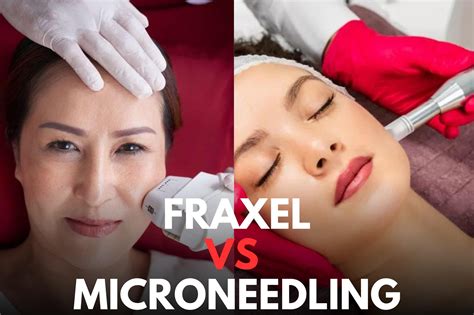 fraxel vs microneedling