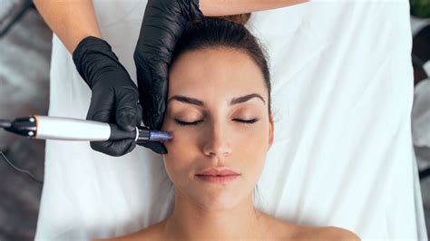 how long after microneedling can i use retinol