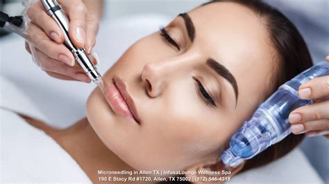 microneedling allen tx