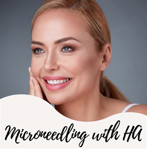 microneedling and hyaluronic acid