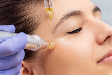 microneedling and prp cost