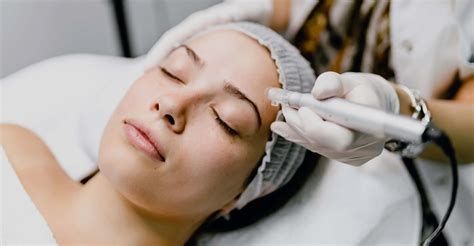 microneedling costs near me