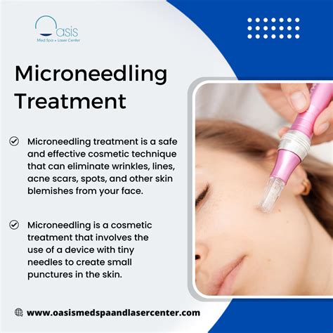 microneedling dallas tx