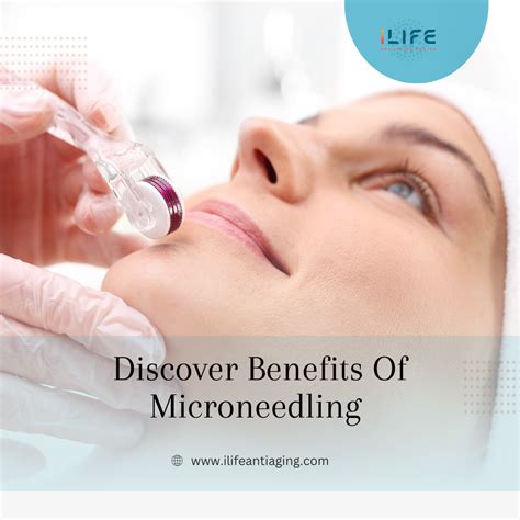 microneedling in houston