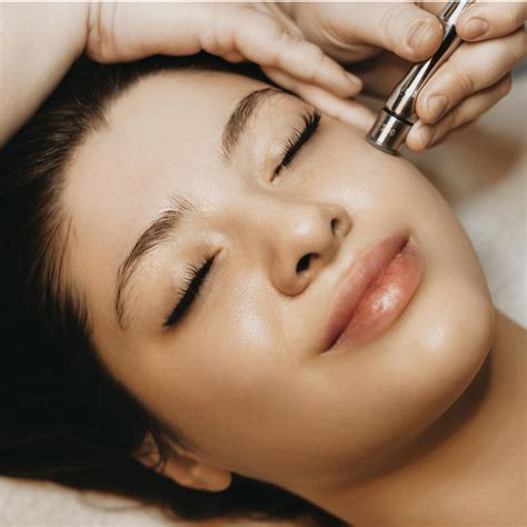 microneedling in los angeles