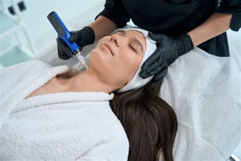 microneedling in tucson