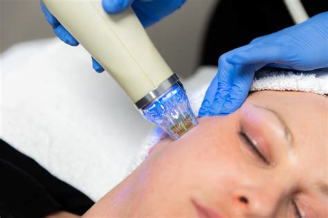 microneedling kansas city