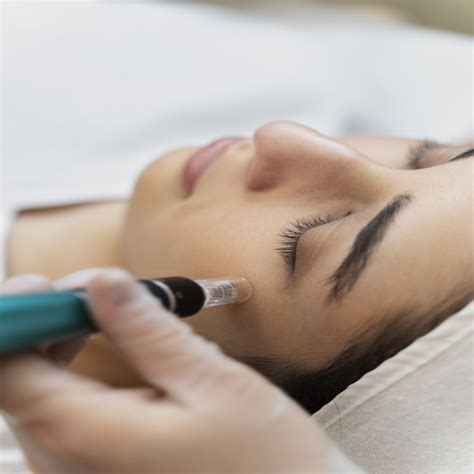 microneedling los angeles