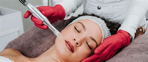 microneedling newport beach