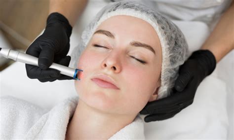 microneedling orange county