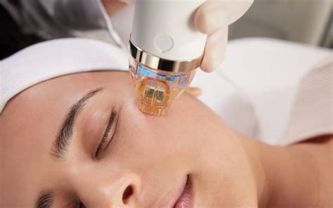 microneedling orlando