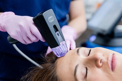 microneedling philadelphia