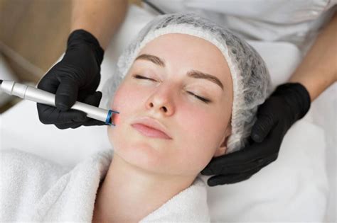 microneedling san antonio