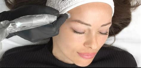 microneedling vs microblading