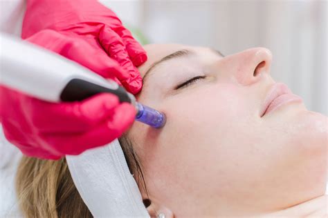 professional microneedling