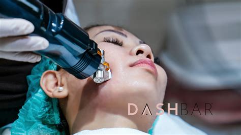 radio frequency microneedling near me