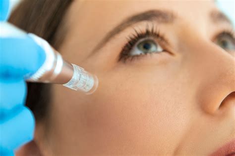 rejuvapen microneedling